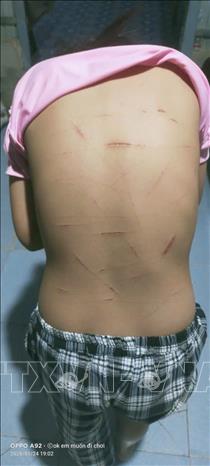 Qua xác minh ban đầu, các vết thương trên cơ thể em T.T.N là do dao cắt giấy gây ra. Ảnh: TTXVN phát