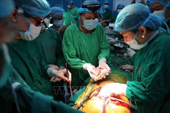 Ghép phổi là quy trình kỹ thuật cao, yêu cầu sự phối hợp chặt chẽ, chính xác gần như tuyệt đối giữa nhiều chuyên khoa: phẫu thuật, gây mê, hồi sức, nội hô hấp, dinh dưỡng, kiểm soát nhiễm khuẩn…Ảnh: Minh Quyết - TTXVN