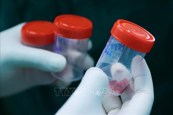 Phần mẫu ở phổi được lấy đem đi nuôi cấy. Ảnh: Minh Quyết - TTXVN