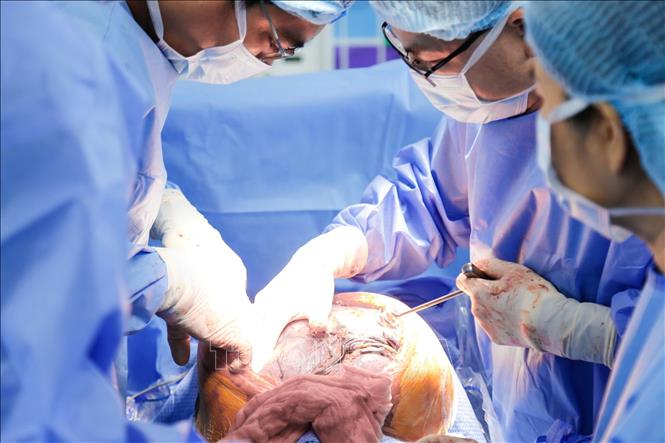 Các bác sĩ Bệnh viện Từ Dũ Thành phố Hồ Chí Minh tiến hành phẫu thuật bóc tách khối u xơ tử cung khổng lồ cho bệnh nhân. Ảnh: TTXVN phát 