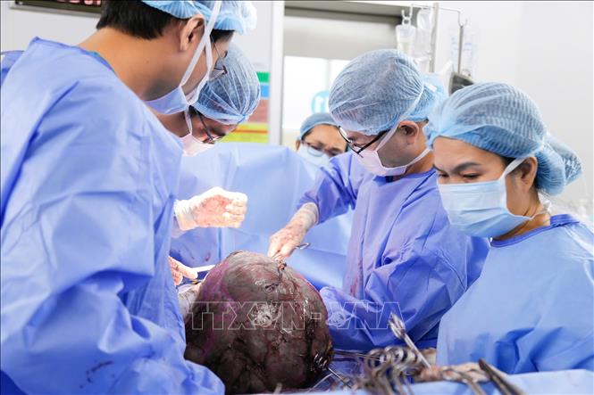 Các bác sĩ Bệnh viện Từ Dũ Thành phố Hồ Chí Minh tiến hành phẫu thuật bóc tách khối u xơ tử cung khổng lồ cho bệnh nhân. Ảnh: TTXVN phát 
