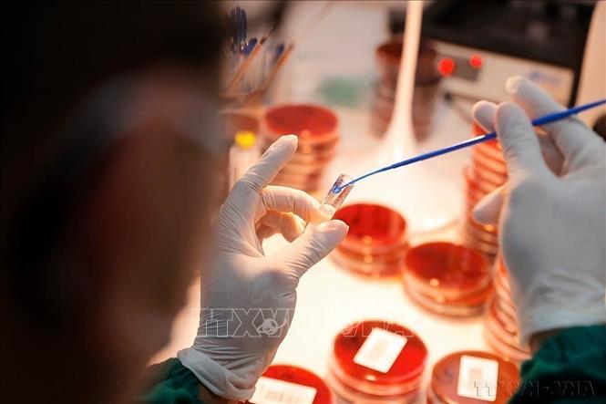 Test định danh vi khuẩn, vi nấm của Khoa Vi sinh và Labo lao chuẩn quốc gia (bệnh viện Phổi Trung ương). Ảnh: Minh Quyết - TTXVN