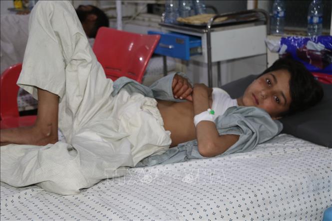 Em nhỏ bị thương trong đợt pháo kích tại Kunar, Afghanistan, ngày 27/4/2026. Ảnh: THX/TTXVN