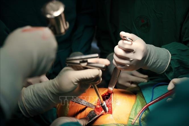 Thay khớp háng nhân tạo là một phương pháp phẫu thuật để điều trị những bệnh nhân tổn thương khớp háng do bệnh lý hoặc chấn thương như thoái hóa khớp, hoại tử chỏm xương đùi, gãy cổ xương đùi, gãy xương vùng đầu trên xương đùi... mà tất cả các phương pháp điều trị khác không đem lại hiệu quả. Ảnh: Minh Quyết - TTXVN
