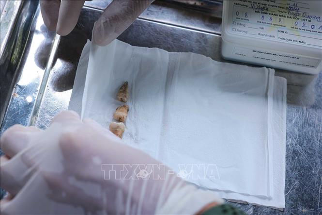 Bones and teeth are prioritized when collecting samples from martyrs' remains for DNA testing. VNA Photo: Hoàng Hiếu
