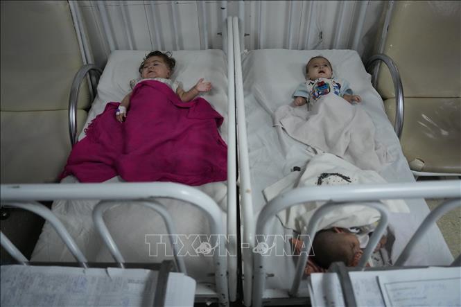 Các em nhỏ bị suy dinh dưỡng được điều trị tại bệnh viện ở Kabul, Afghanistan. Ảnh: THX/TTXVN phát