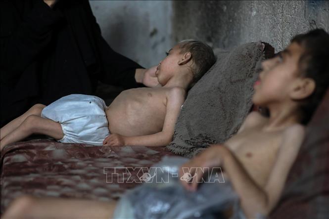 Các em nhỏ bị suy dinh dưỡng tại Gaza. Ảnh: THX/TTXVN phát