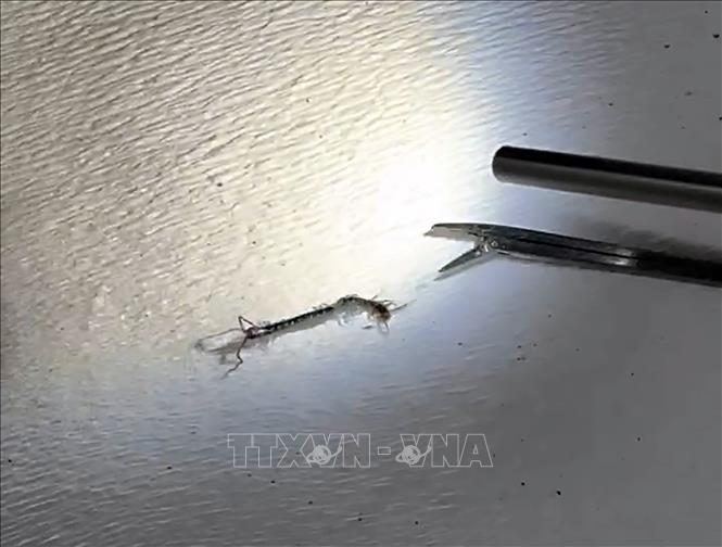 Dị vật xác rết được gắp khỏi tai thiếu niên sau thủ thuật nội soi. Ảnh: TTXVN phát