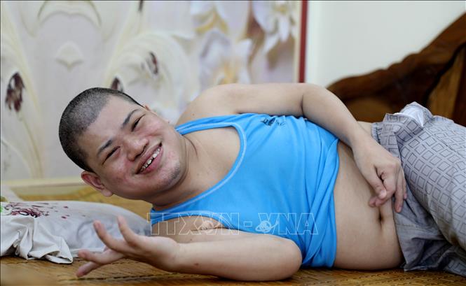 Anh Nguyễn Văn Sang (thôn Thượng Bái xã Diên Hà, tỉnh Hưng Yên) bị ảnh hưởng bởi chất độc cam/dioxin nằm liệt giường 41 năm nay, mọi sinh hoạt hàng ngày đều phải nhờ người thân. Ảnh: Thế Duyệt - TTXVN
