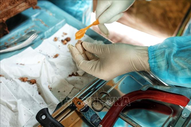Cán bộ y tế có chuyên môn làm sạch và kiểm tra mẫu hài cốt trước khi lựa chọn mẫu phù hợp phục vụ giám định ADN, góp phần xác định danh tính liệt sĩ. Ảnh: Phạm Tuấn Anh - TTXVN