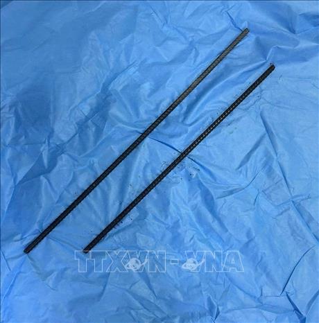 Hai thanh sắt được rút ra từ cơ thể nạn nhân sau phẫu thuật can thiệp. Ảnh: TTXVN phát